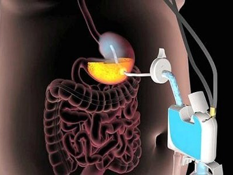 an-vao-roi-hut-ra-ban-co-dam-thu-cach-giam-can-nay