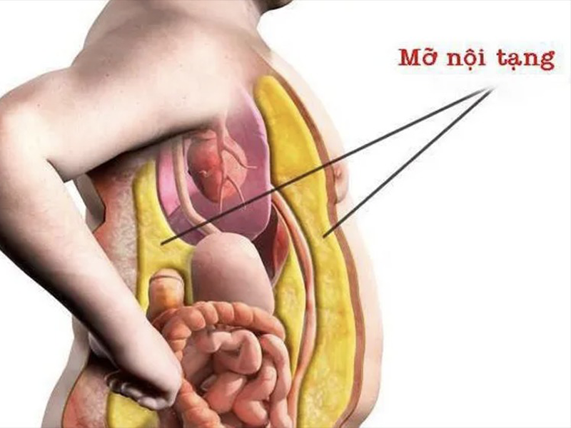 beo-phi-mo-noi-tang-nguon-con-nhieu-tat-benh-nguy-hiem