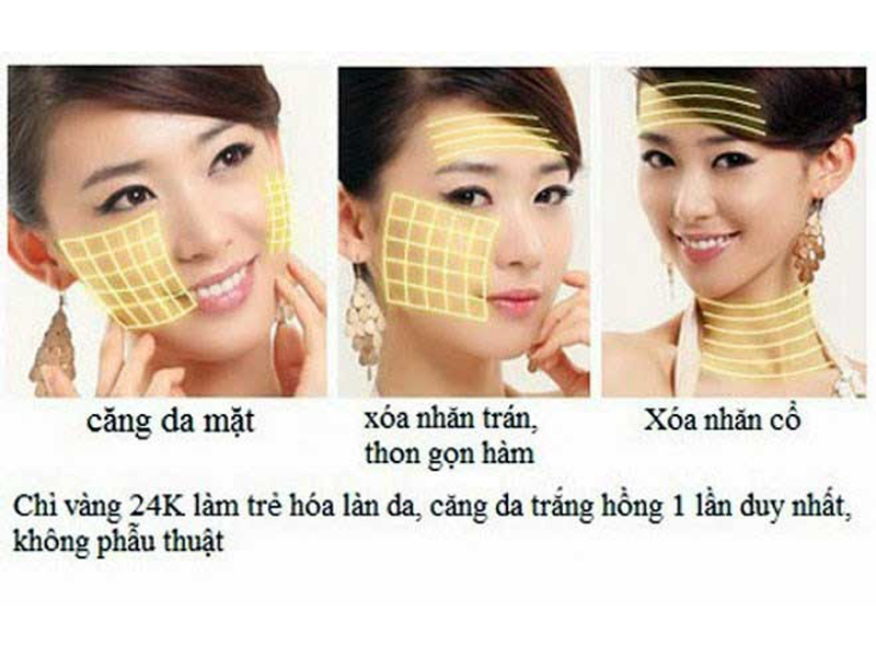 cang-da-khong-phau-thuat-bang-chi-vang