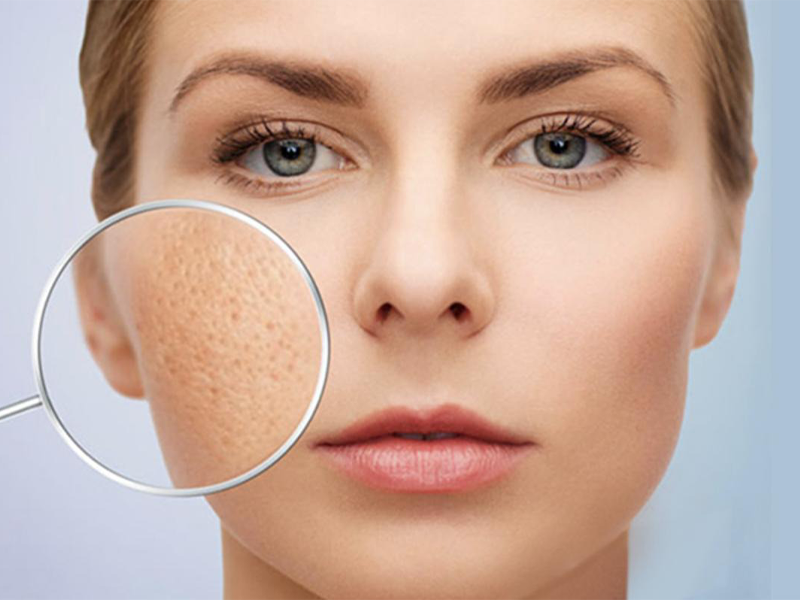 duong-chat-cho-lan-da-tham-ro-vi-mun