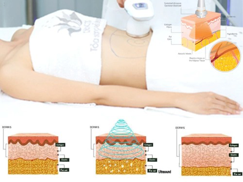 eo-thon-dang-dep-nho-cong-nghe-cavi-deluxe