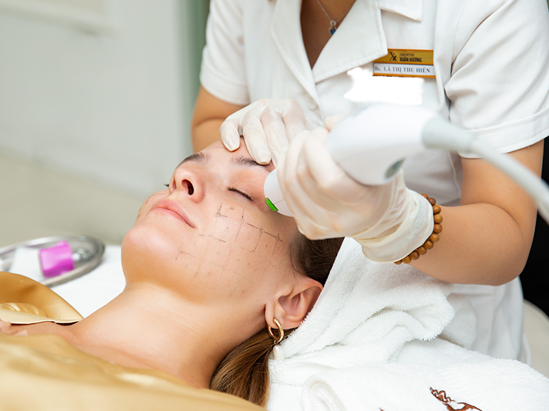 giam-chay-xe-lan-da-nho-cong-nghe-thermage