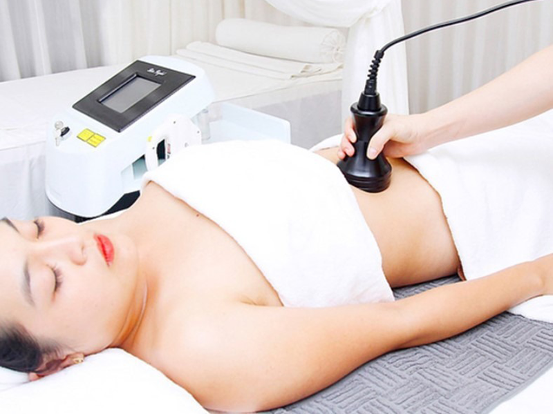 giam-mo-bung-khong-phau-thuat-theo-cong-nghe-cavi-lipo