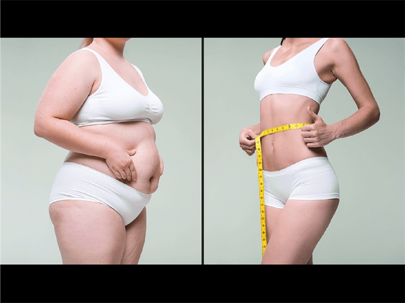 giam-mo-bung-sau-sinh-the-nao-cho-nhanh-va-an-toan