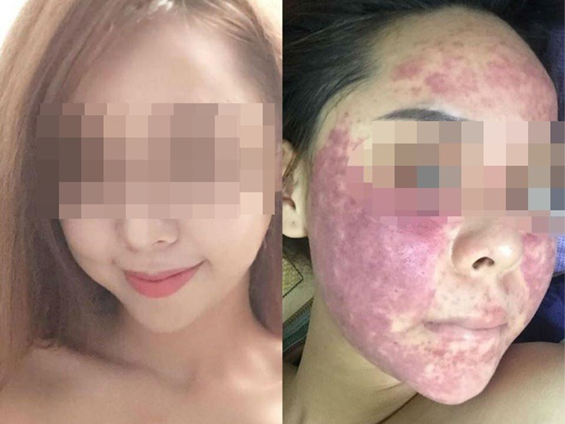 ham-trang-da-sieu-toc-chi-em-khoc-meu-vi-kem-tron