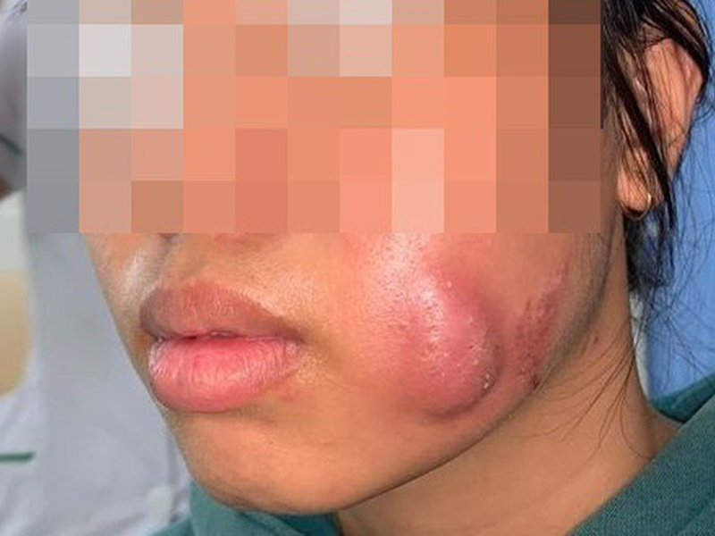 mat-sung-vu-vi-lam-ma-lum-dong-tien-gia-re