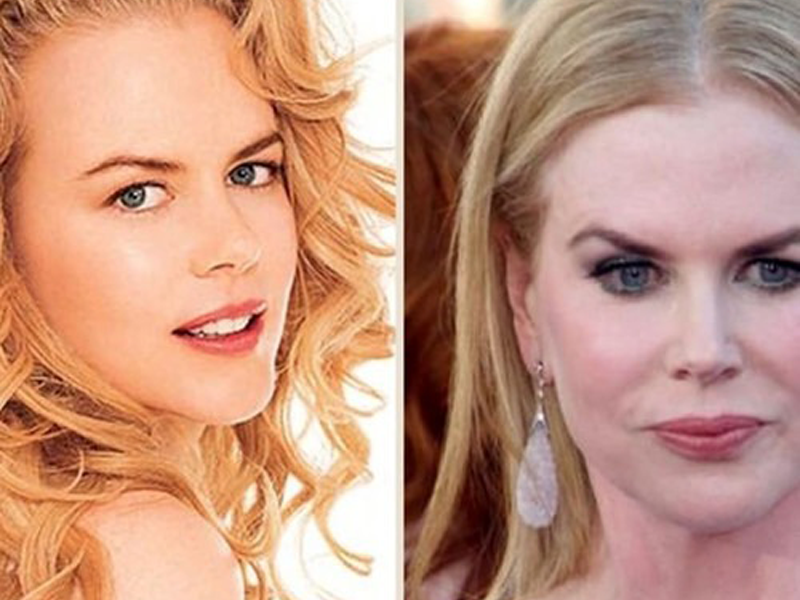 my-nhan-hollywood-kho-so-vi-phau-thuat-tham-my-hong