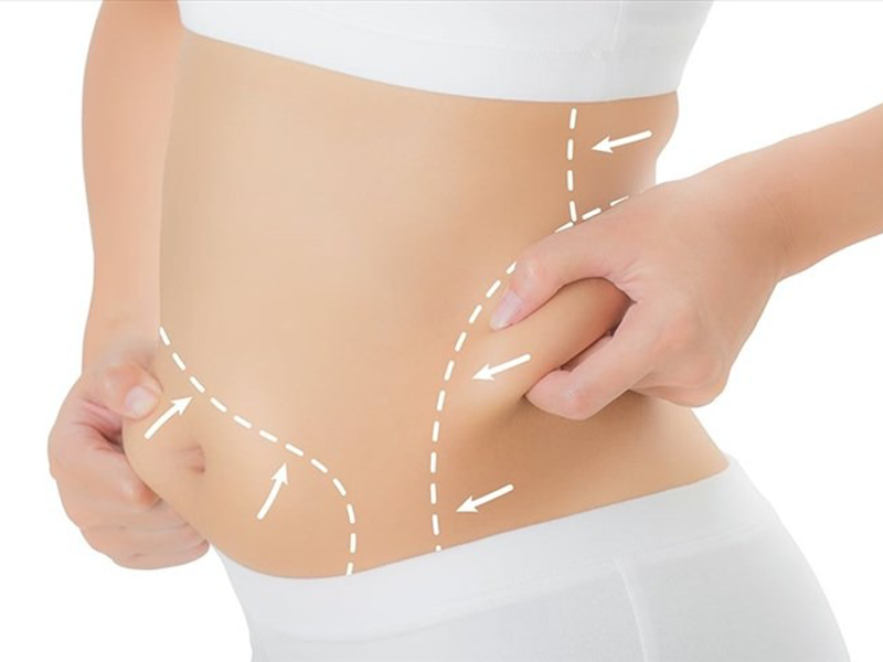 nguy-co-bom-hut-mo-tu-than-lam-dep