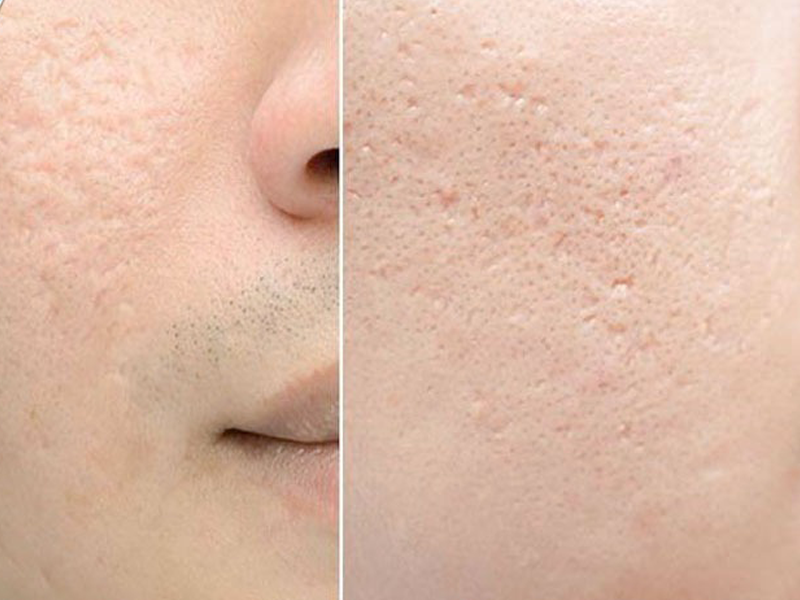 them-mot-cong-nghe-lam-day-seo-lom