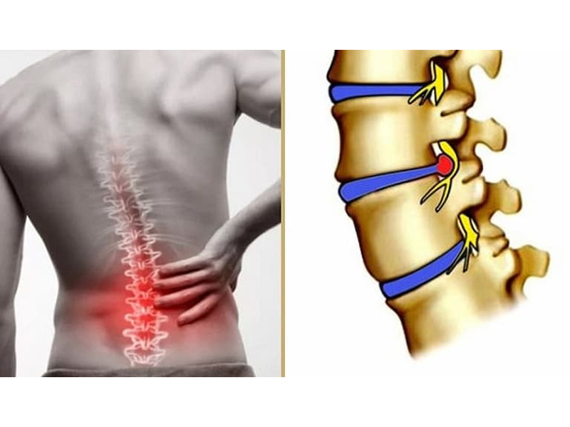 thoai-hoa-dia-dem-mo-co-la-ac-mong