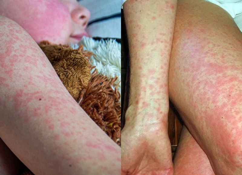 ban-soi-va-sot-phat-ban